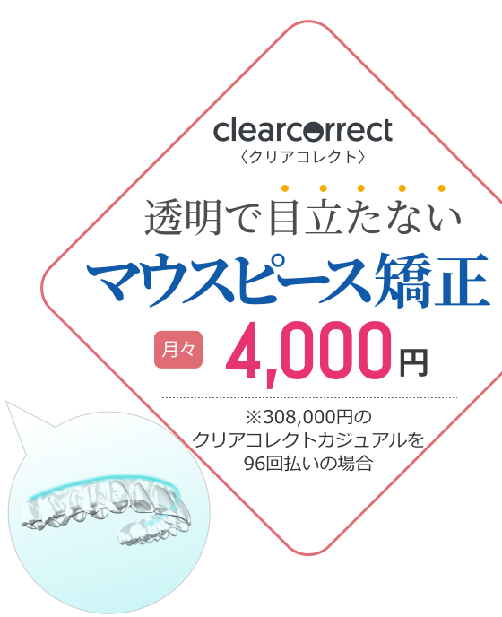 clearcorrect(クリアコレクト)透明で目立たないマウスピース矯正